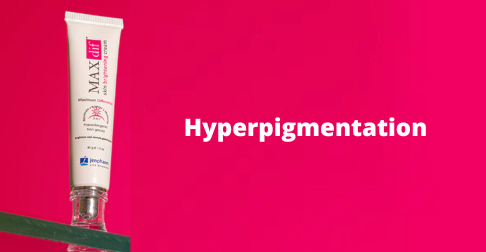 Best Hyper Pigmentation Creams of 2022